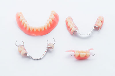 Almaden Valley Smile Design | Invisalign reg , All-on-6 reg  and Dental Implants